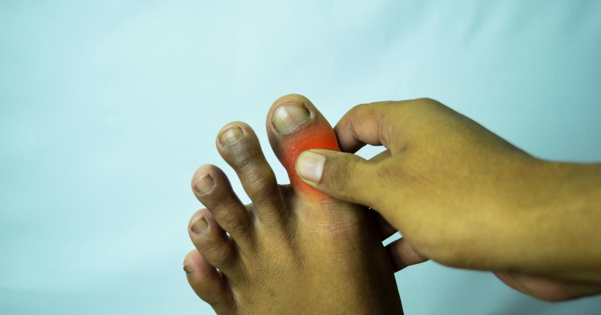 arthritis-in-your-feet-causes-symptoms-and-treatment