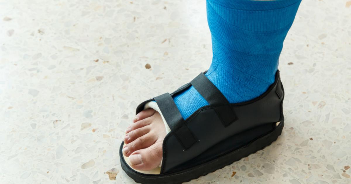 Conseils Pour Se Remettre D Une Fracture Ou D Une Luxation Du Pied