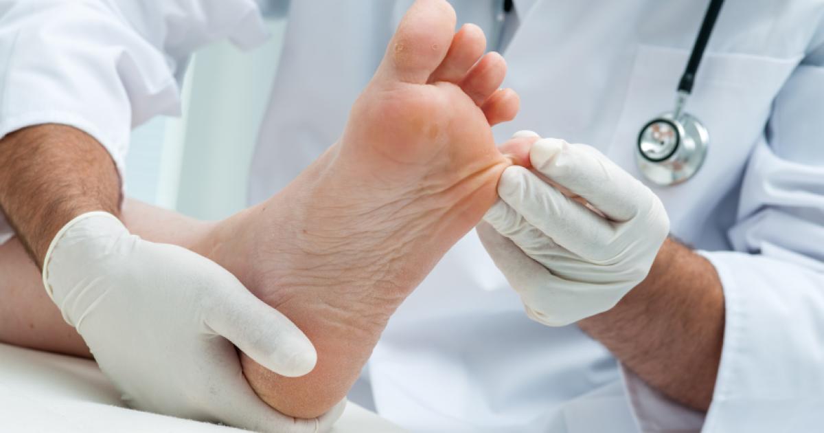 Bosse du pied Symptômes, causes, traitements