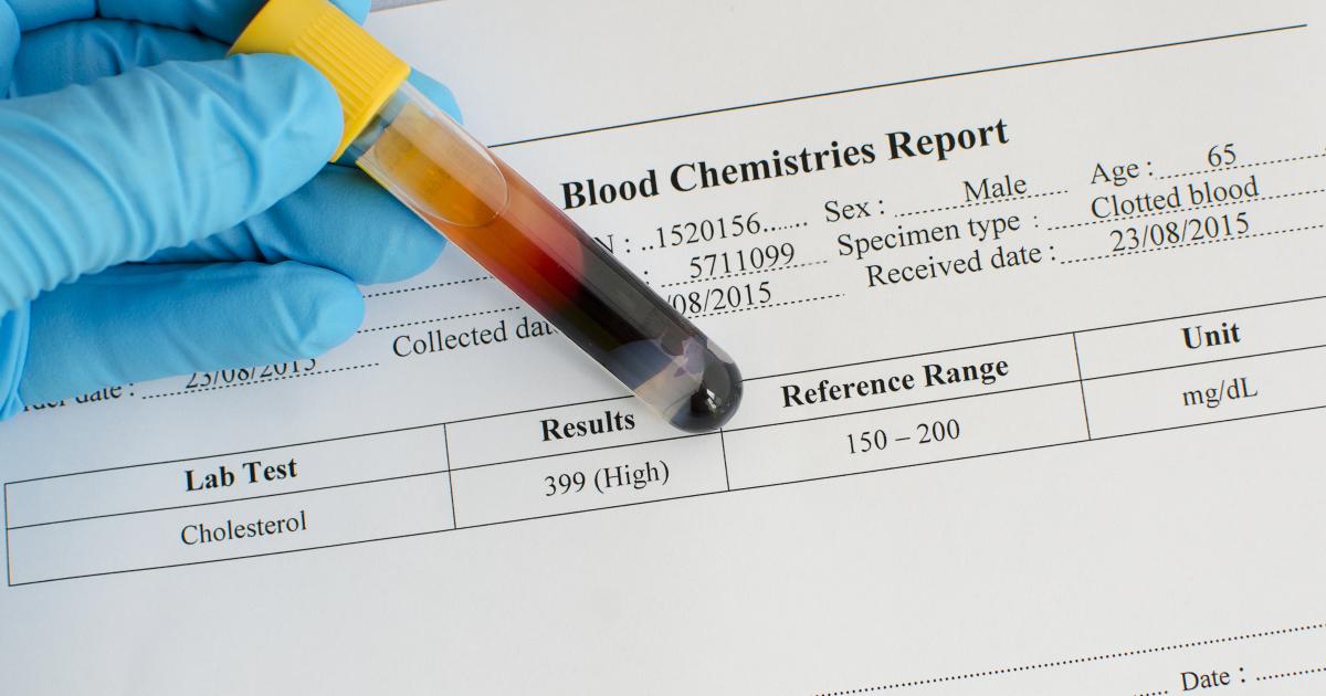 Taux de cholestérol élevé Causes, facteurs de risque, symptômes et traitements