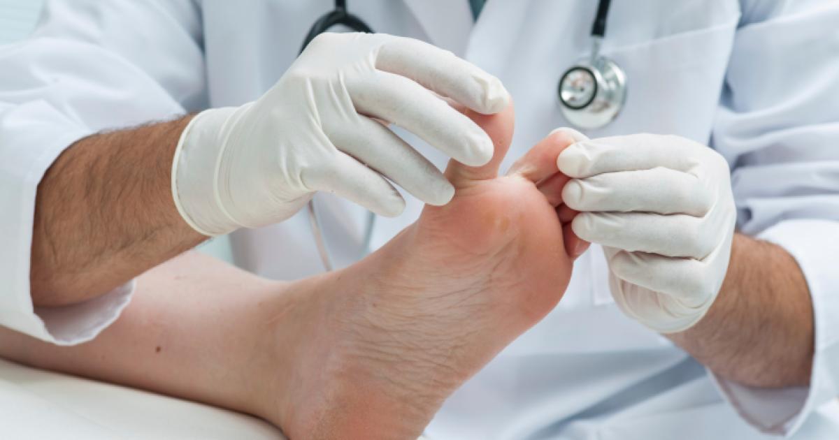 Engourdissement des orteils Orteils engourdis Symptômes, causes, traitements, diagnostic