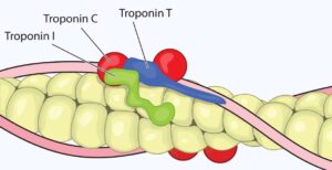 Taux de troponine : Signification d'un taux élevé, tests, plage normale
