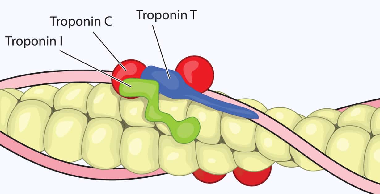 Taux De Troponine Signification D un Taux lev Tests Plage Normale